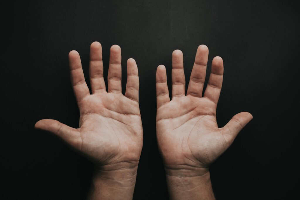 A close-up image of two open palms on a dark background, conveying a sense of openness.
